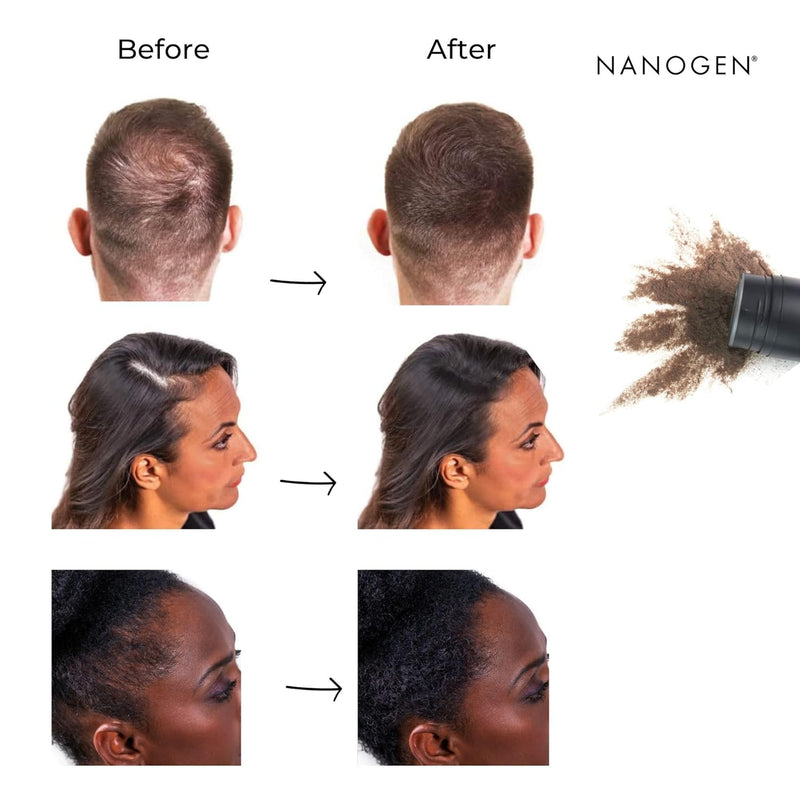 Nanogen Keratin Hair Fibres 30 Grams Shade No. 04 (Dark Blonde)
